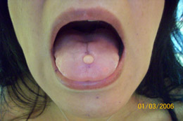 tongue piercing san diego