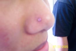 Nose Piercing in San Diego